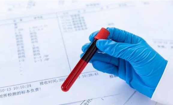 廣東司法親子鑒定大概多少錢？需要哪些手續？