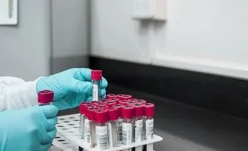 中山親子鑒定多久才能出結果？