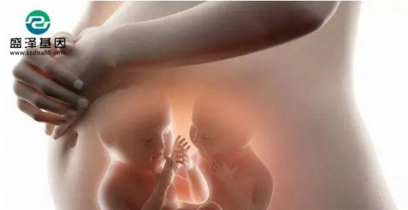 醫(yī)學(xué)怪病奇美拉現(xiàn)象:親自生未必是親生?你身體還住著另一個(gè)人? 醫(yī)學(xué)怪病奇美拉現(xiàn)象:親自生未必是親生?你身體還住著另一個(gè)人?