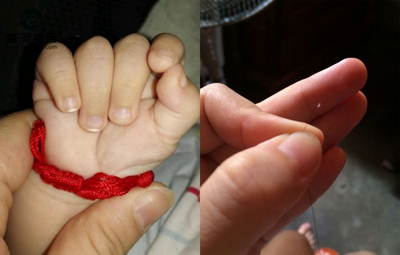 親子鑒定樣本怎么采集？采集頭發