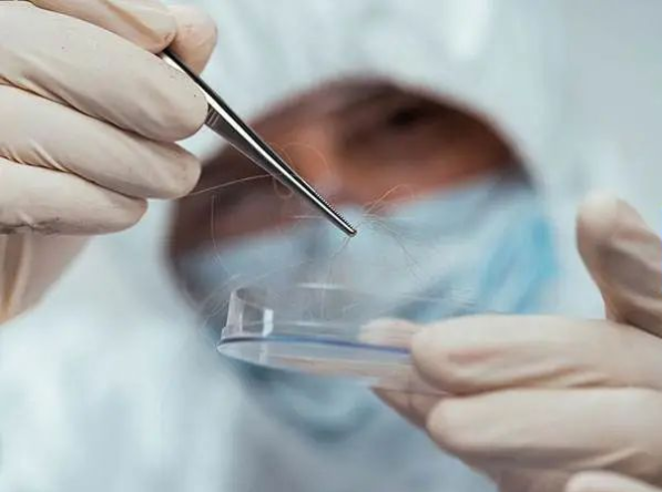 隨便拔下一根帶毛囊的毛發(fā)可以做親子鑒定樣本嗎？