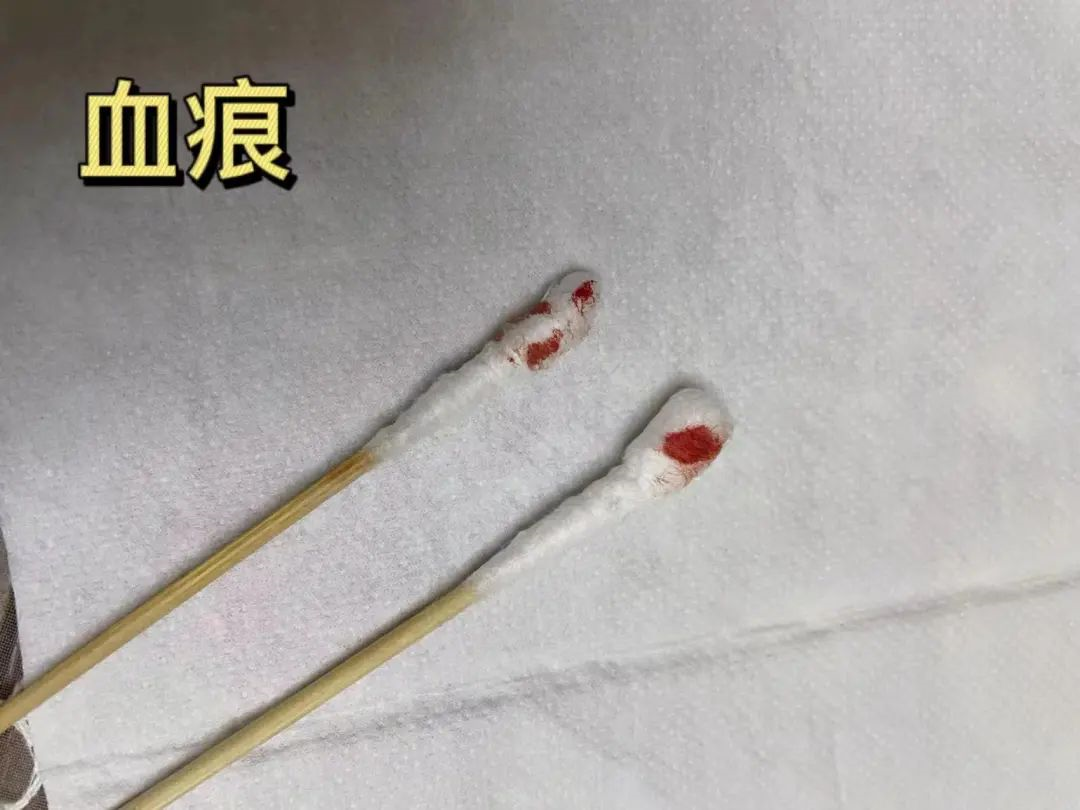 親子鑒定樣本采集棉棒上的血痕可以嗎？