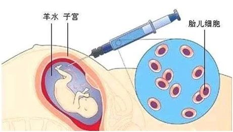 無創胎兒親子鑒定、羊水親子鑒定、毛發親子鑒定分別怎么做? 無創胎兒親子鑒定、羊水親子鑒定、毛發親子鑒定分別怎么做?
