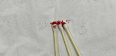 個人親子鑒定可以郵寄血樣檢材嗎？樣本有哪些注意事項？