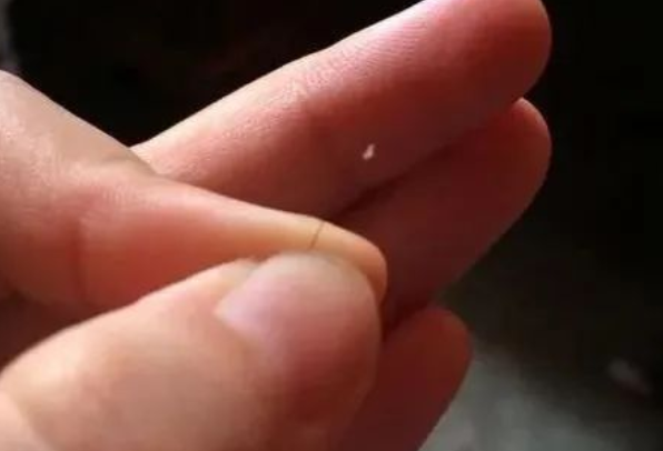 掉落的毛囊毛發(fā)可以拿去做染色體親子鑒定嗎？