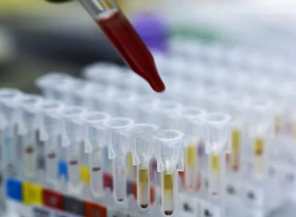 探秘個人親子鑒定和司法親子鑒定,什么是兩聯體、三聯體? 探秘個人親子鑒定和司法親子鑒定,什么是兩聯體、三聯體?