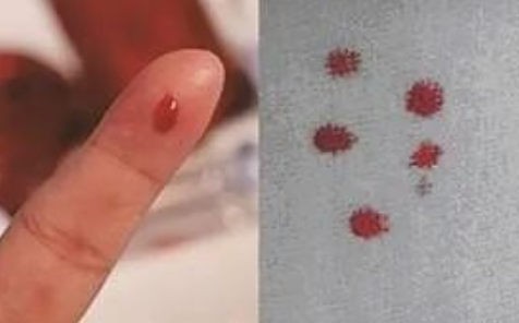 匿名親子鑒定需要準備什么？親子鑒定工作人員采樣本流程有哪些？