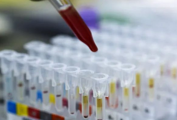 DNA親子鑒定會出錯嗎？根據樣本檢測位點出錯的概率是多少呢？