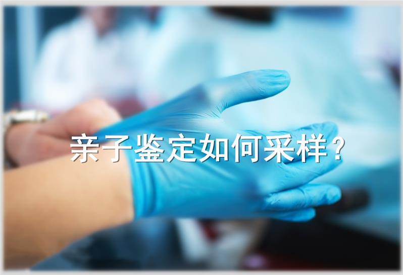 什么情況下需要做中山親子鑒定，需要什么證件？