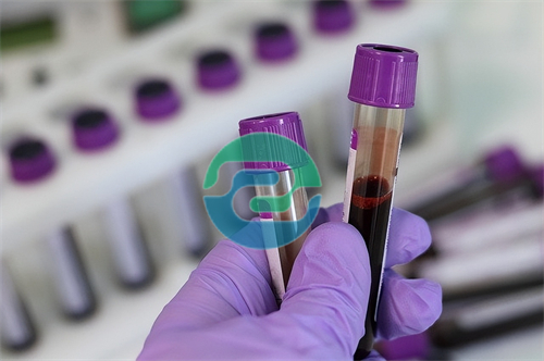 中山孕期胎兒親子鑒定的秘密方法介紹