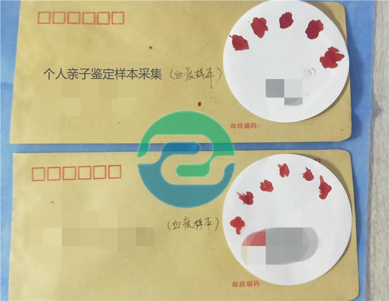 孕期中山親子鑒定結(jié)果準確嗎？能相信結(jié)論嗎？